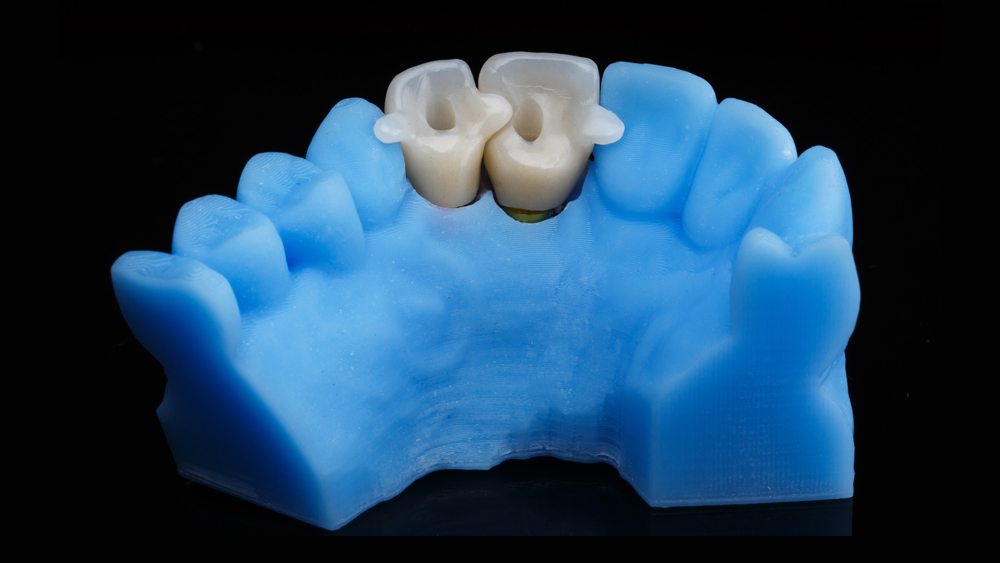 Quality-Crown-and-Bridge-Lab_Service_3d-dental-model